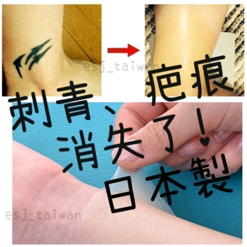 ESJ台灣現貨 日本製防水遮刺青貼布 遮刺青貼紙 遮疤痕 隱形隱藏 遮曬痕遮暇 遮蓋刺青 超薄超貼合貼紙貼布