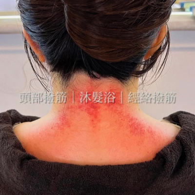 頭部撥筋沐髮頭皮全套
