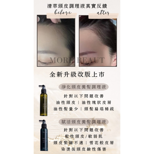 淨化頭皮養髮調理液（乾髮使用）