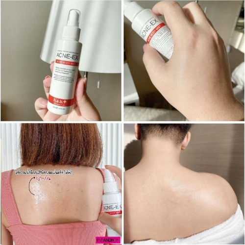 現貨 正版公司貨中文標已登錄 ACNE-EX Acne Body Mist 身體淨痘調理噴霧 120ml