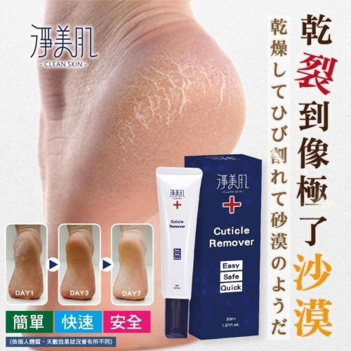 【粿女兒商行】?現貨 淨美肌 死皮角質軟化液 30ML