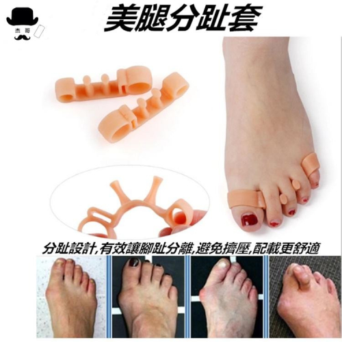 腳趾分趾器 ?平價現貨?(高材質) 腳趾套 美腿分趾器 美腿分趾套 美腿分趾器 分趾套 美腿神器 腳趾固定器